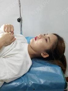 成人鼻子清洗神器图片视频,高效便捷的鼻腔清洁新体验